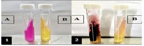 salmonella urease test